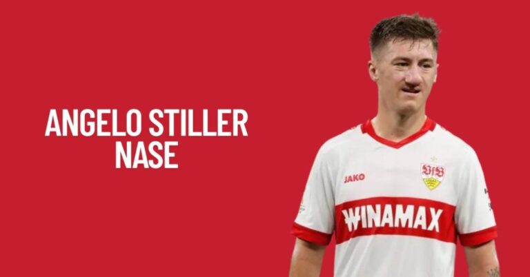 Angelo Stiller Nase